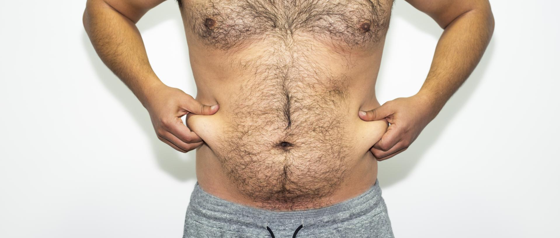 plastic surgery options for men, man holding his abdomen skin