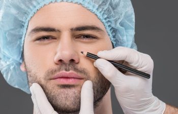 doctor drawing lines for facelifting on handsome man