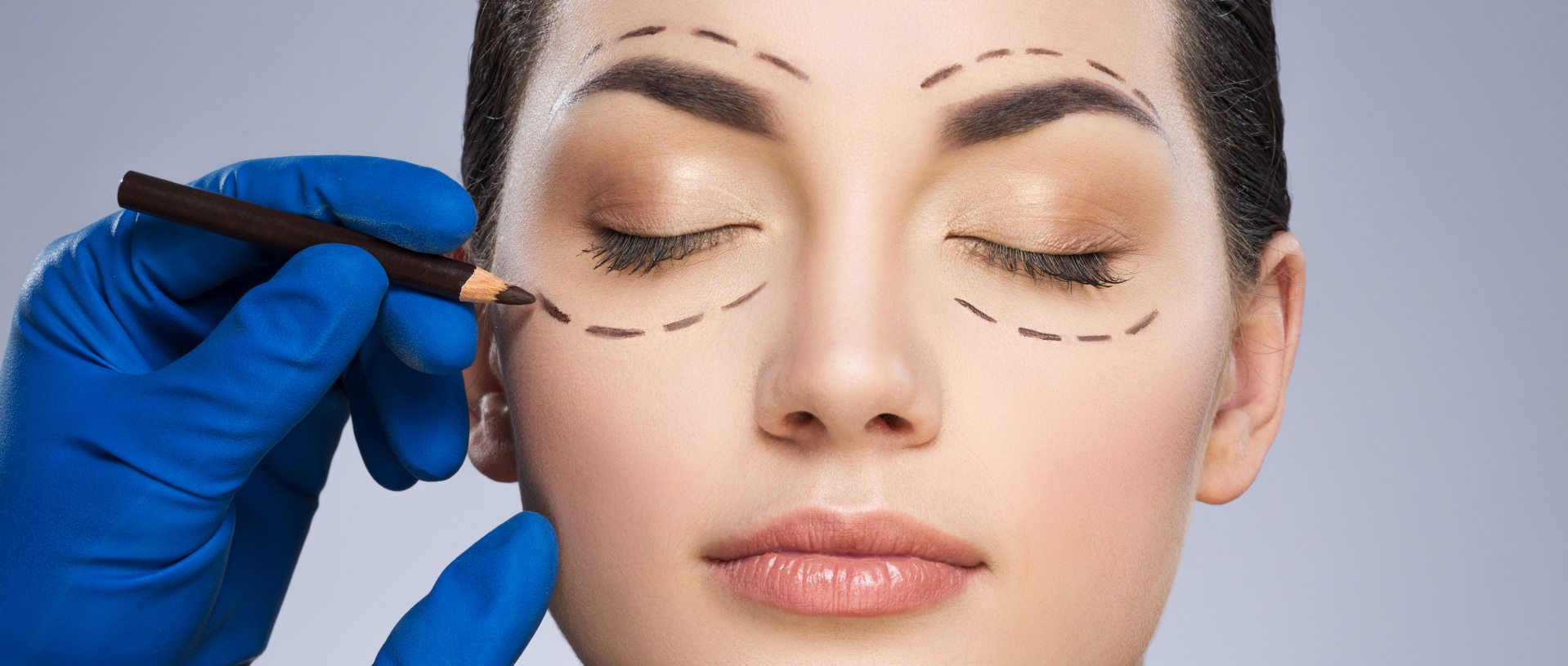 plastic surgeon drawing dashed lines around closed eyes of girl
