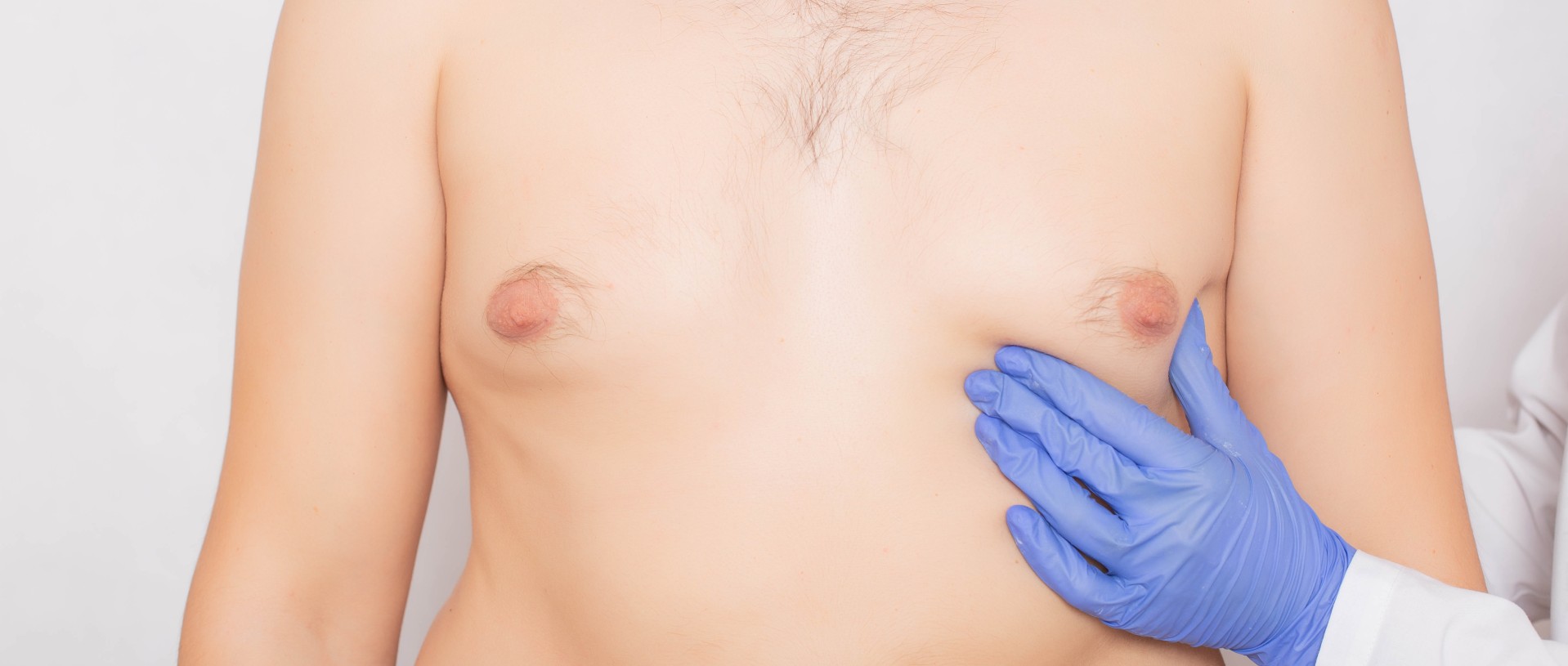 plastic surgeon doctor examines the male breast before surgery to reduce breas