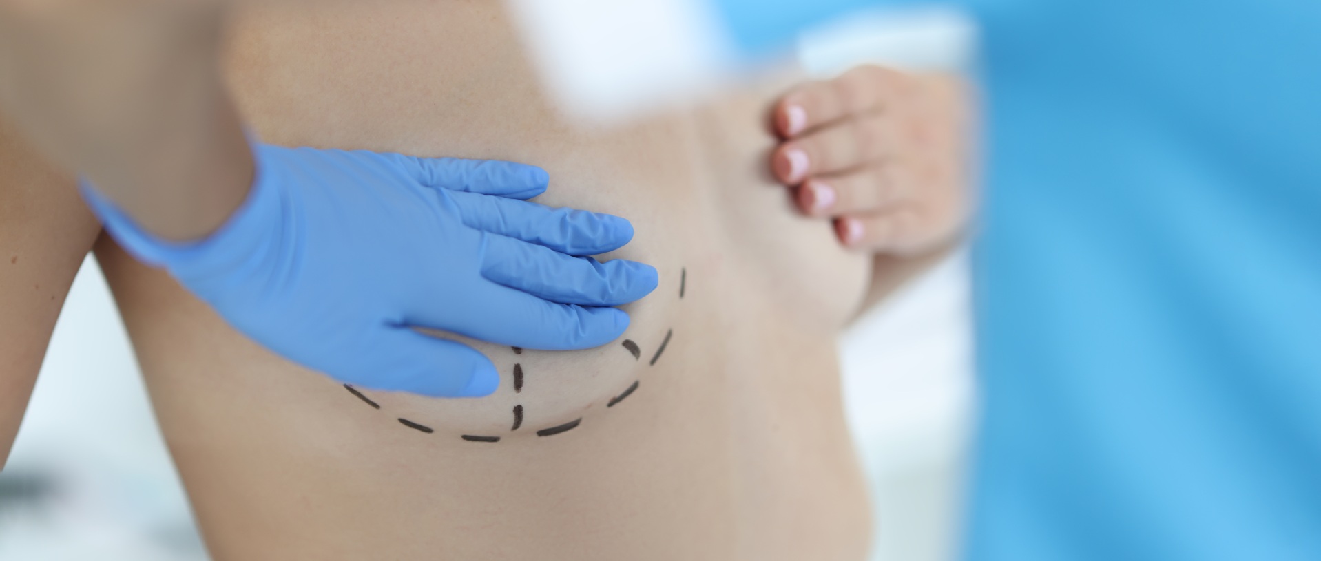 plastic surgery breast augmentation and lift concept