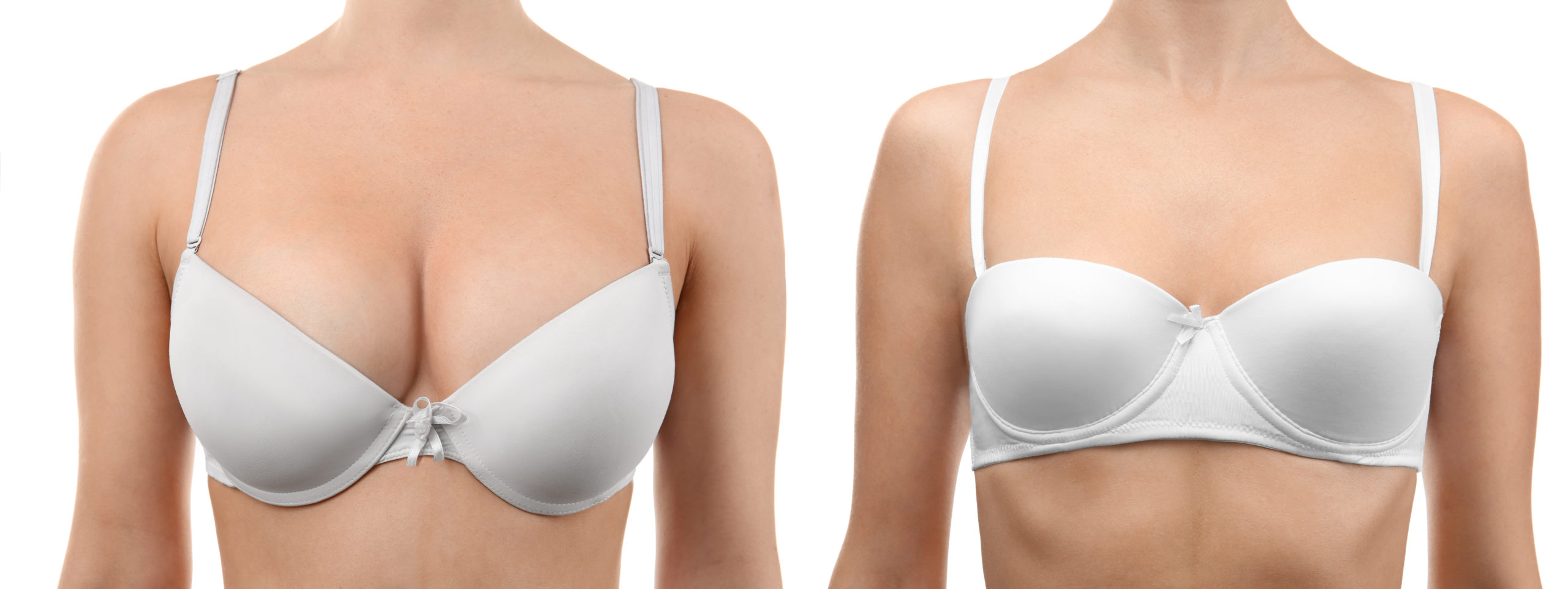 breast with and without implants