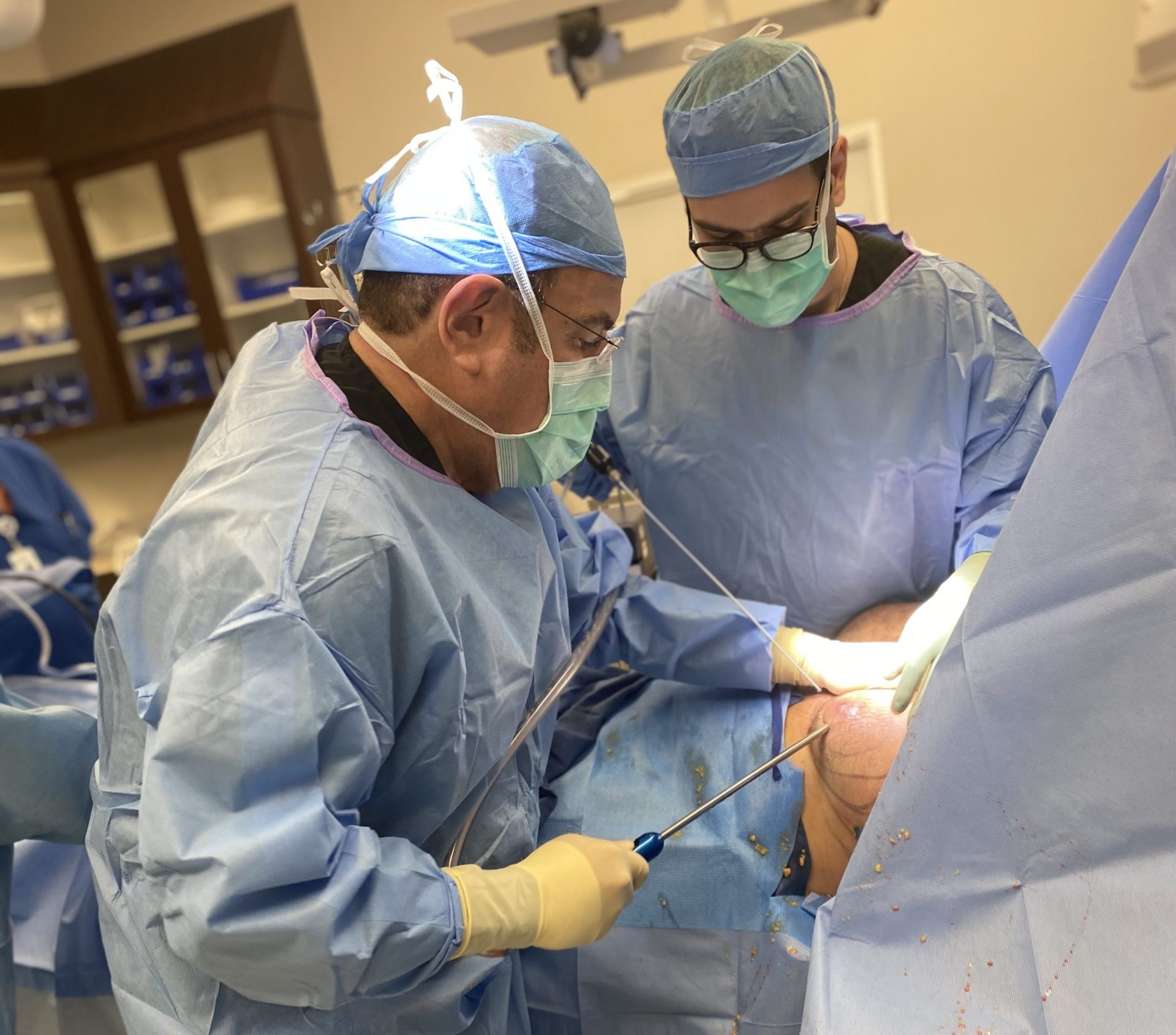 Liposuction Surgery Dallas | Dr. David Azouz | Dr. Solomon Azouz