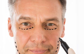 man with lines on his face