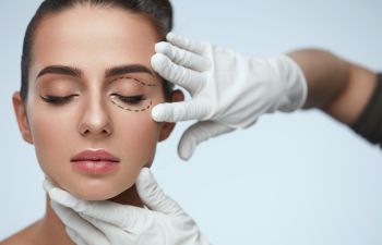 Eyelid Surgery Markings