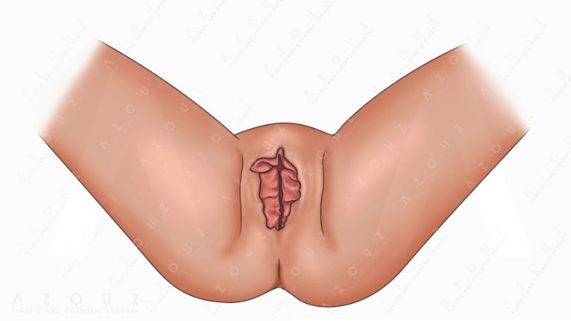 vagina illustration