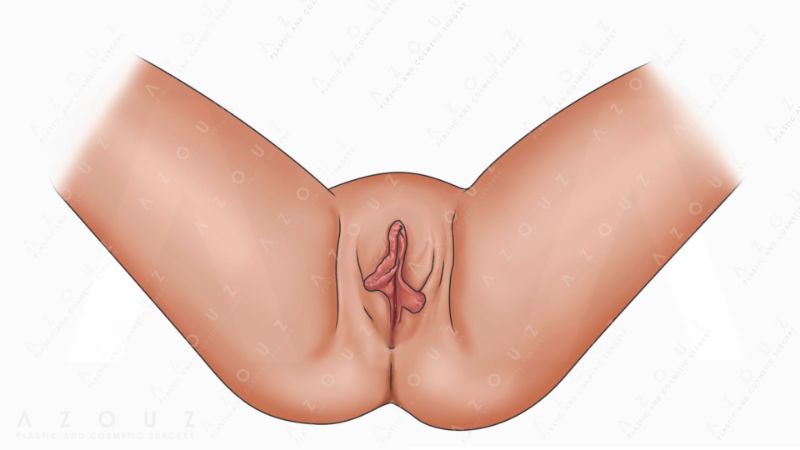 vagina illustration