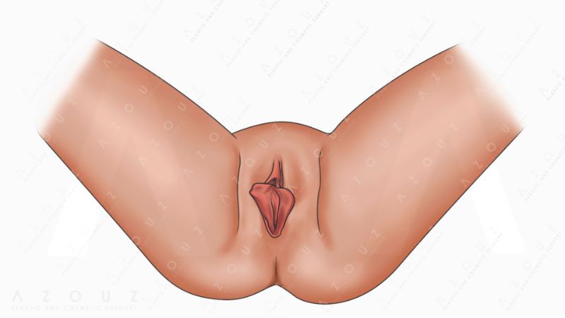 vagina illustration