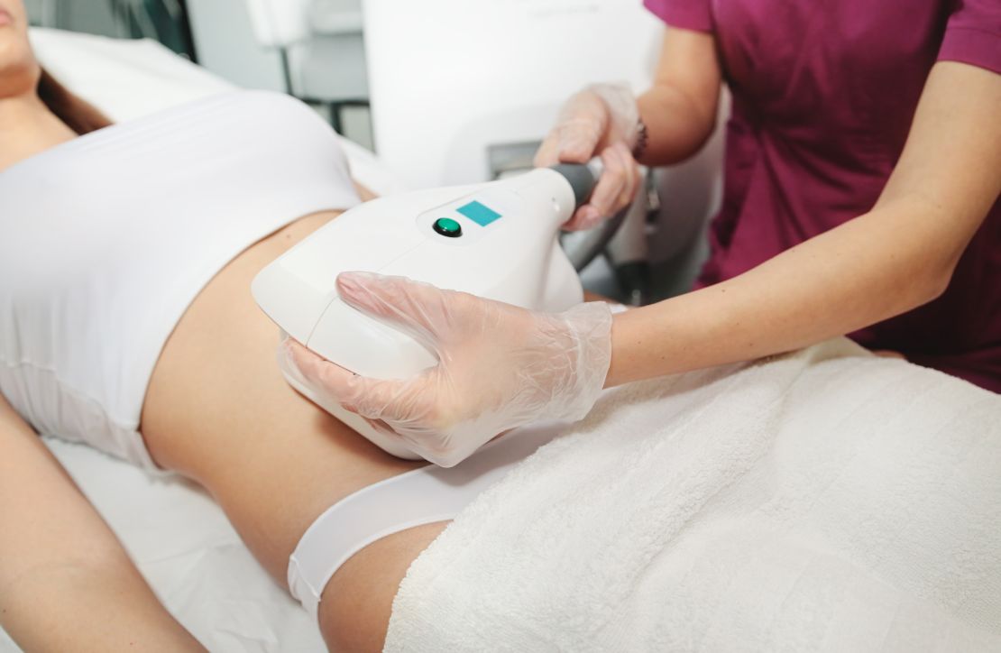 Cool sculpting treatment that may lead to paradoxical adipose hyperplasia 