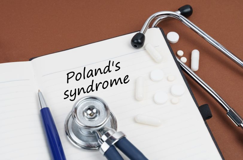 Síndrome de Poland escrito en la libreta, un estetoscopio y medicamentos.
