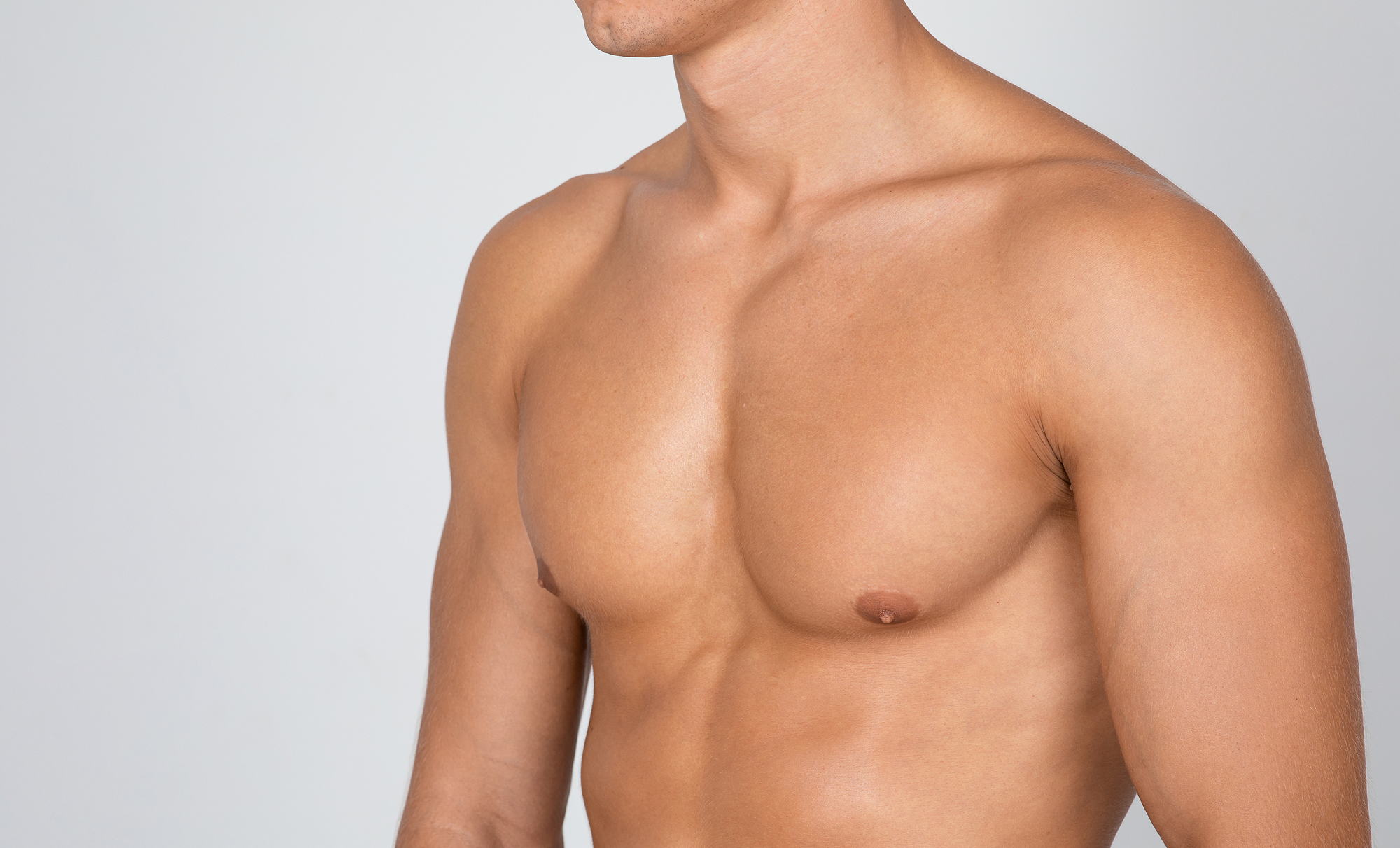 A shirtless man before male boobs removal surgery.