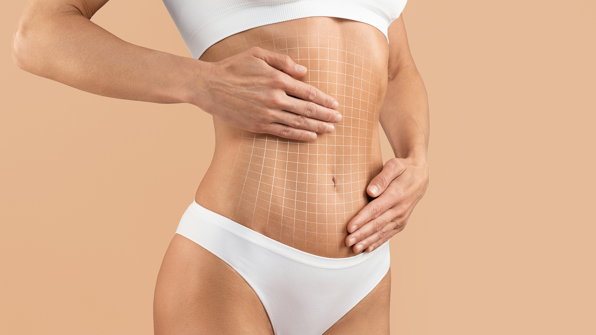 Woman after tummy tuck plastic surgery.