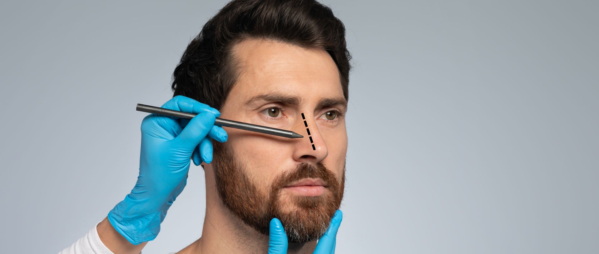 A male rhinoplasty plastic surgeon making surgical lines on a nose of a patient before nose job men surgery.