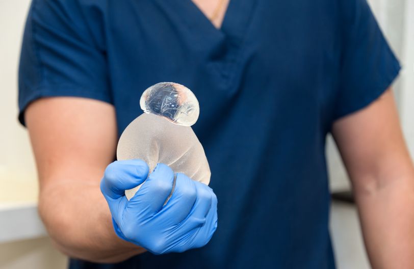 Un cirujano plástico sosteniendo un implante de mama roto y demostrando signos de ruptura de implantes de silicona y solución salina.