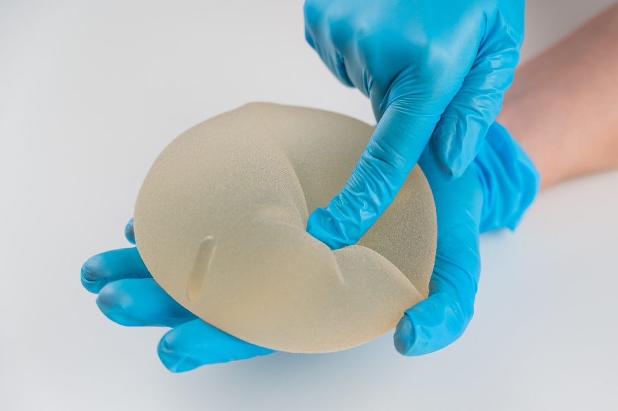 cirugía de implantes mamarios de silicona con fugas en Dallas, TX por el Dr. Azouz