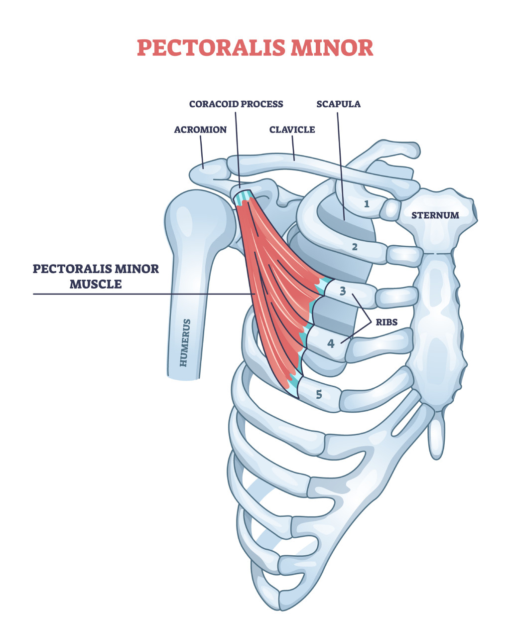 bloqueo del músculo pectoral menor | pectoral menor