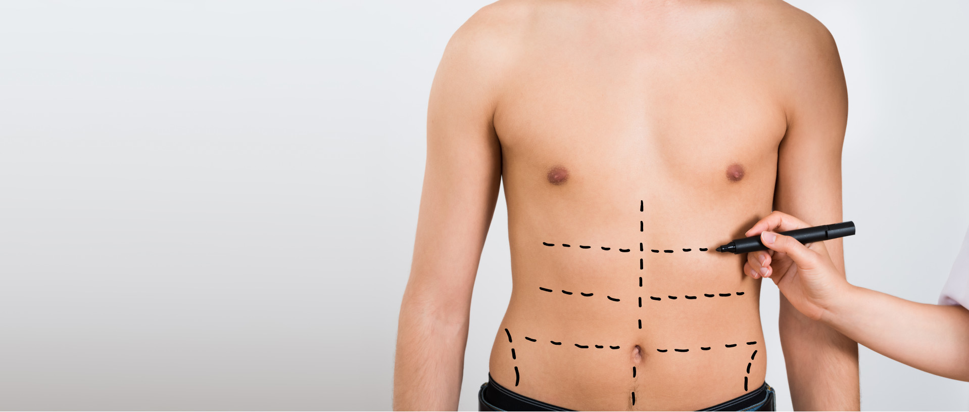 belly lipo | abdominal liposuction surgery
