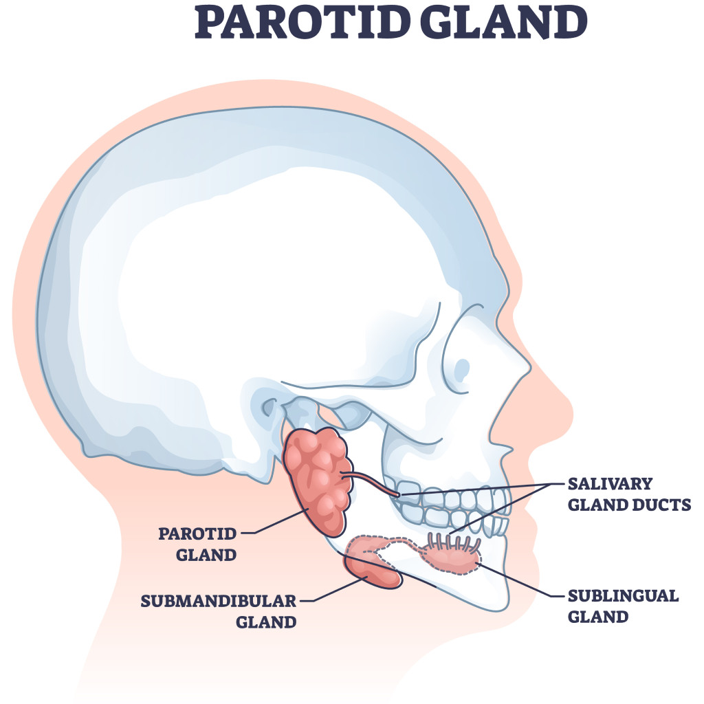 extracción de la glándula parótida | parotidectomía