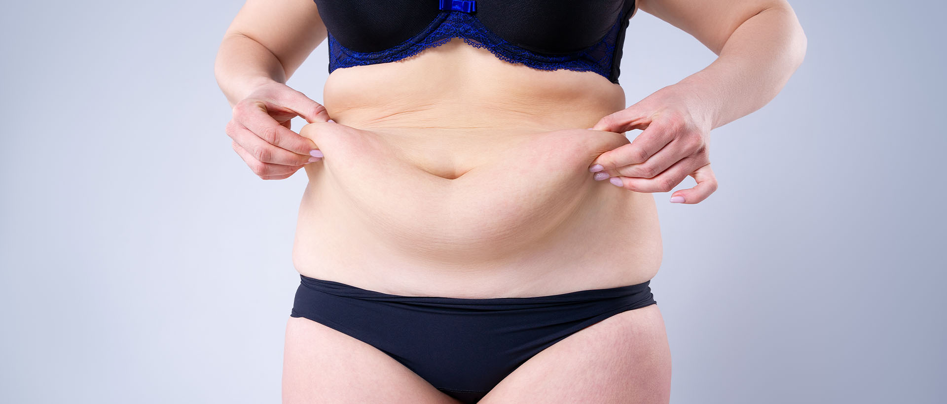 woman holding flabby skin on a fat belly