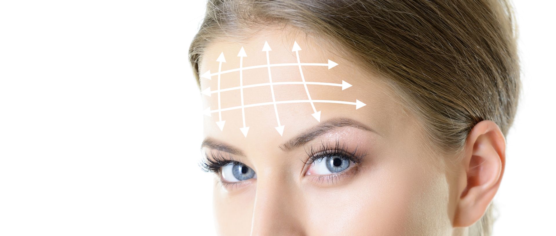 portrait of young woman with white lines on forehead for plastic surgery