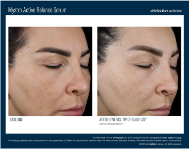 Mystro Active Balance Serum | photo before and after 8 weeks, twice-daily use