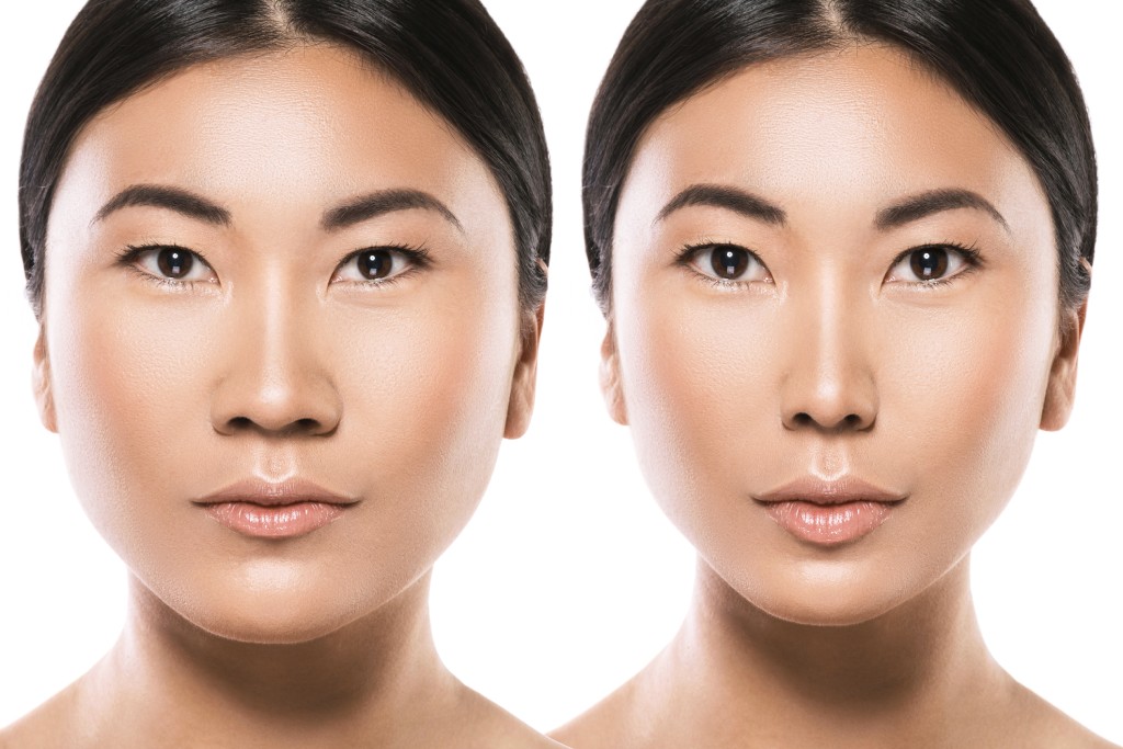 antes y después del trabajo de nariz asiático