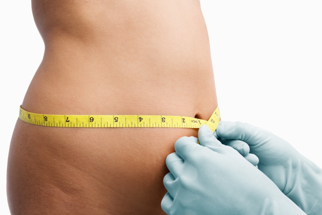 360 liposuction for weight loss