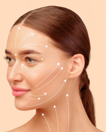 Face of a woman with arrows indicating facelift results