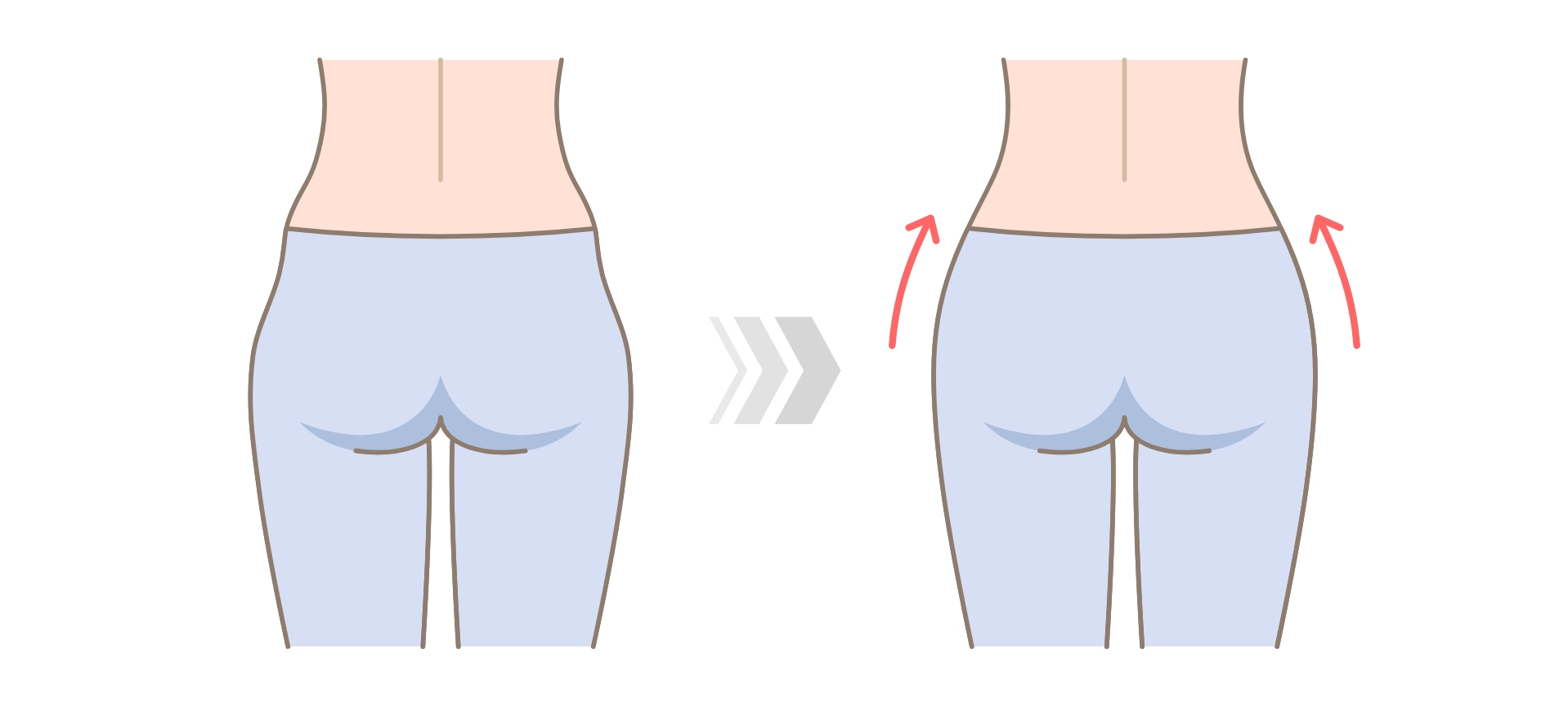 hip dips before and after