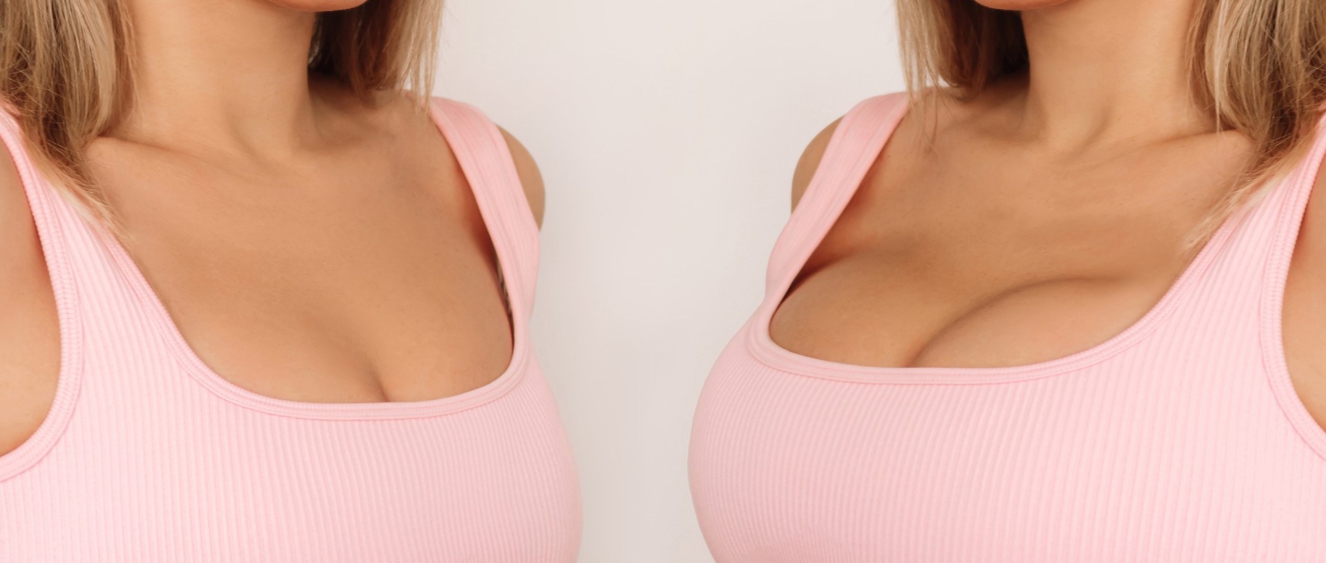 breast augmentation before and after