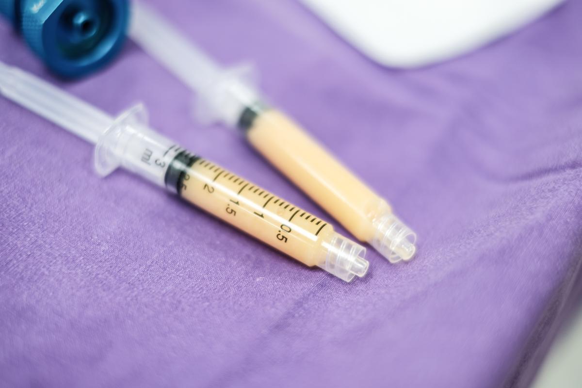 inyección de trasplante de grasa